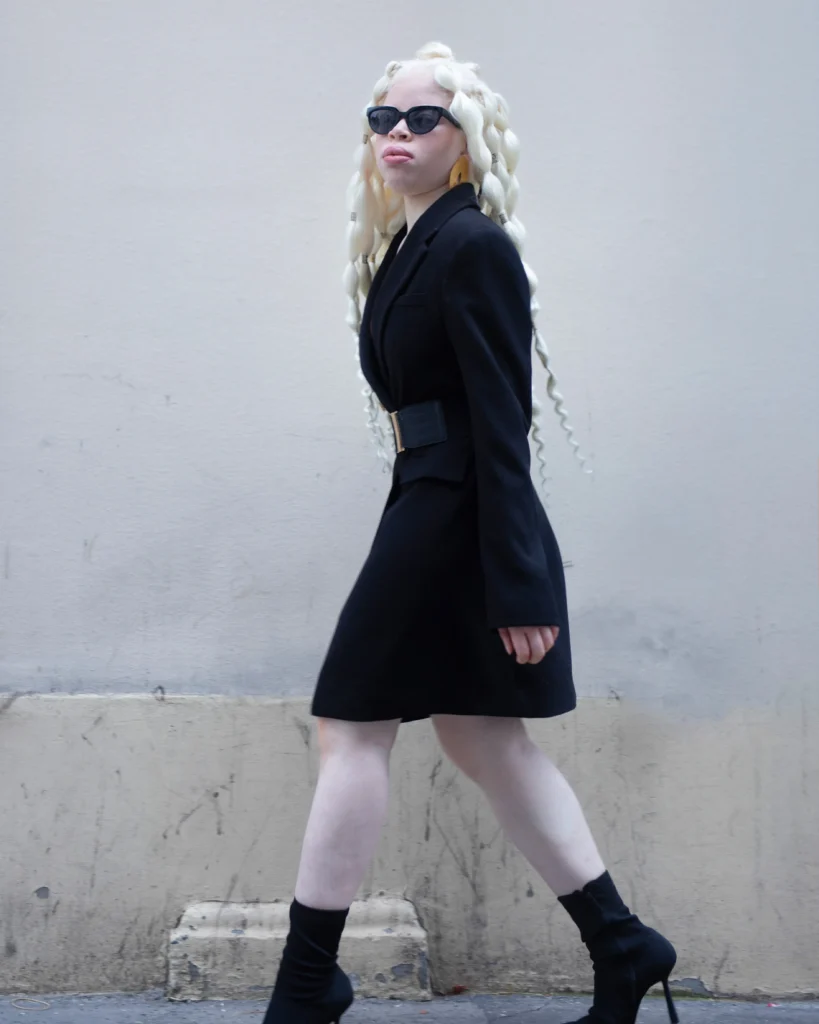 A Black model with albinism wearing a chic black blazer dress, a wide belt, sunglasses, and high-heeled ankle boots, walking confidently in profile along a city wall.