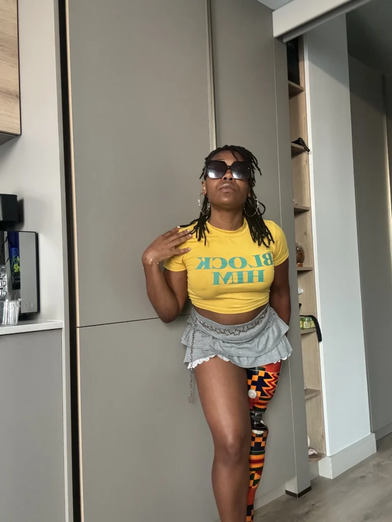 A Black woman leaning against a grey modern kitchen cabinet, wearing large sunglasses, a bright yellow t-shirt that reads "BLOCK HIM," a grey tiered mini skirt with lace trim, and a decorative chain belt. Her right leg is a prosthetic prosthesis featuring a bold, colorful geometric pattern.