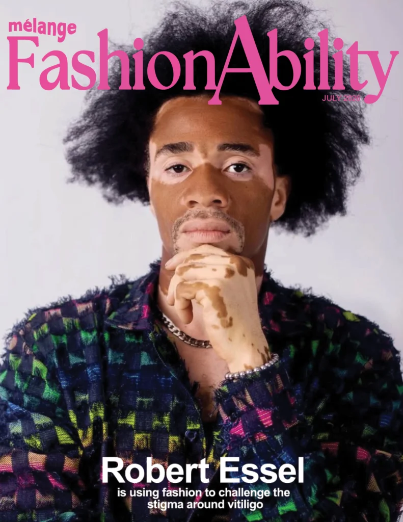 Magazine cover of Mélange FashionAbility July 2026 featuring model Robert Essel with vitiligo, wearing a textured multicolor jacket and silver chain, with text about challenging vitiligo stigma.
