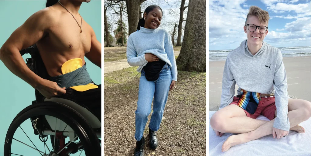 A three-panel photo showing diverse individuals with ostomy bags, including a shirtless man in a wheelchair with a yellow bag, a woman in a park with a black bag, and a person on a beach with a colorful striped pouch cover.