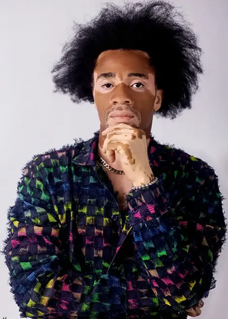 A studio portrait of a male model with vitiligo and an afro looking thoughtfully forward with his hand on his chin, wearing a colorful, textured plaid patterned jacket with a frayed finish.