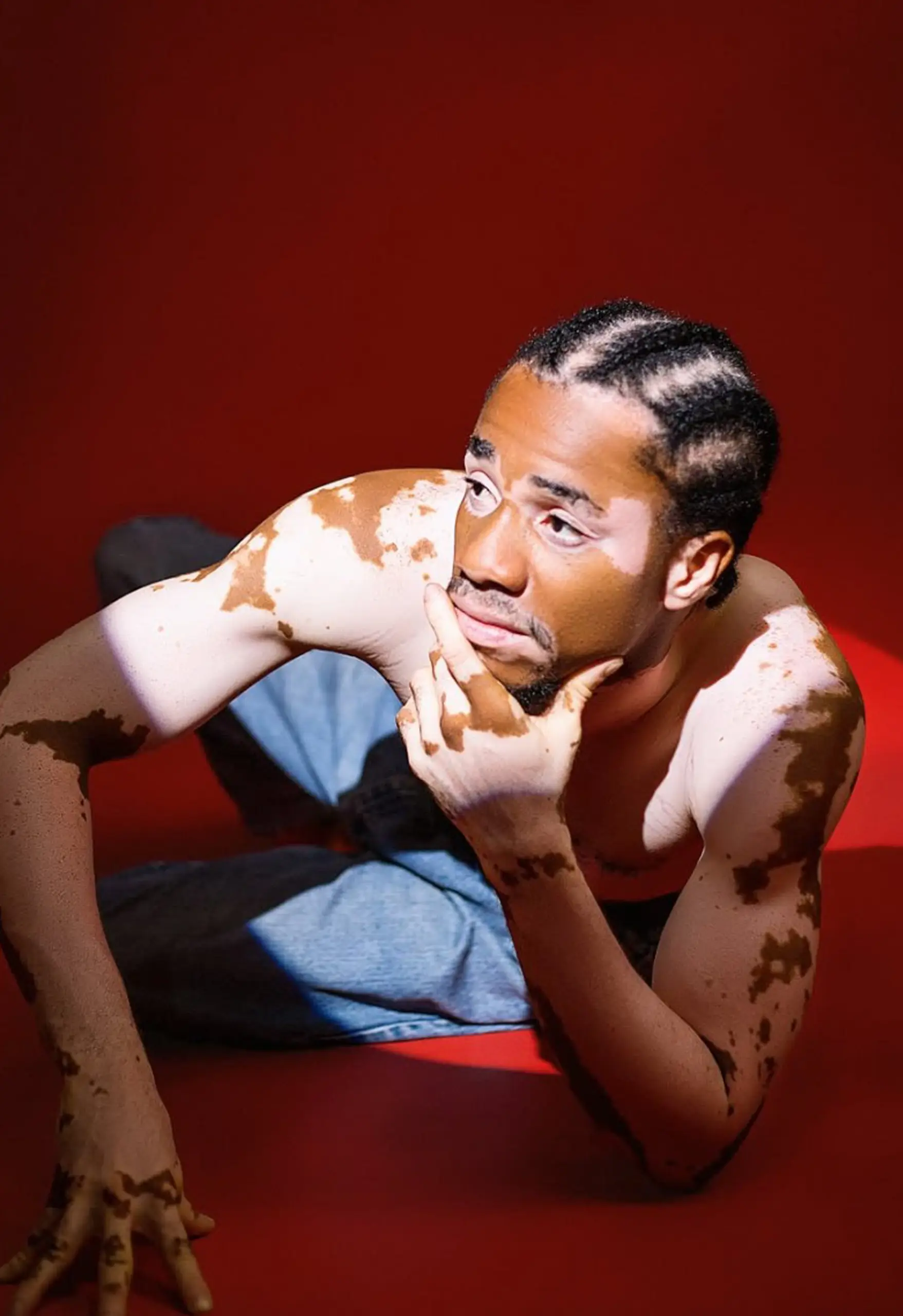 Person with braided hair and patchy skin pigmentation reclines on a red floor, chin resting on one hand and gazing off to the side, in light blue jeans against a deep red background lit by a sharp spotlight.